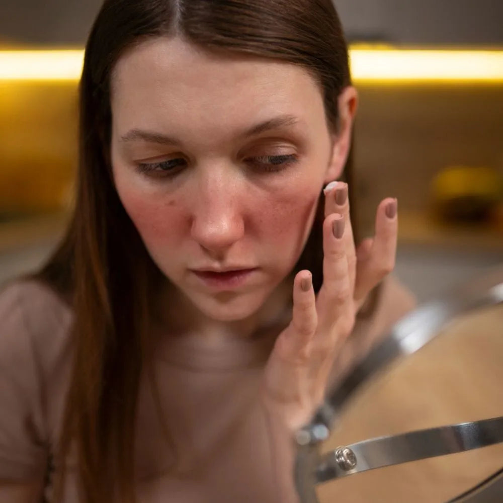 Acne & Breakouts in Pakistan